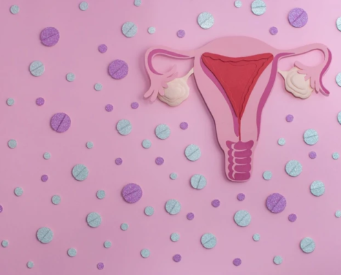 Gebärmutter mit vielen bunten Dienogest-Pillen zur Behandlung von Endometriose.