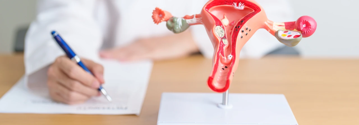 Arzt oder Ärztin sitzt am Schreibtisch und fertig Notizen an. Auf dem Schreibtisch steht ein Uterus-Modell.